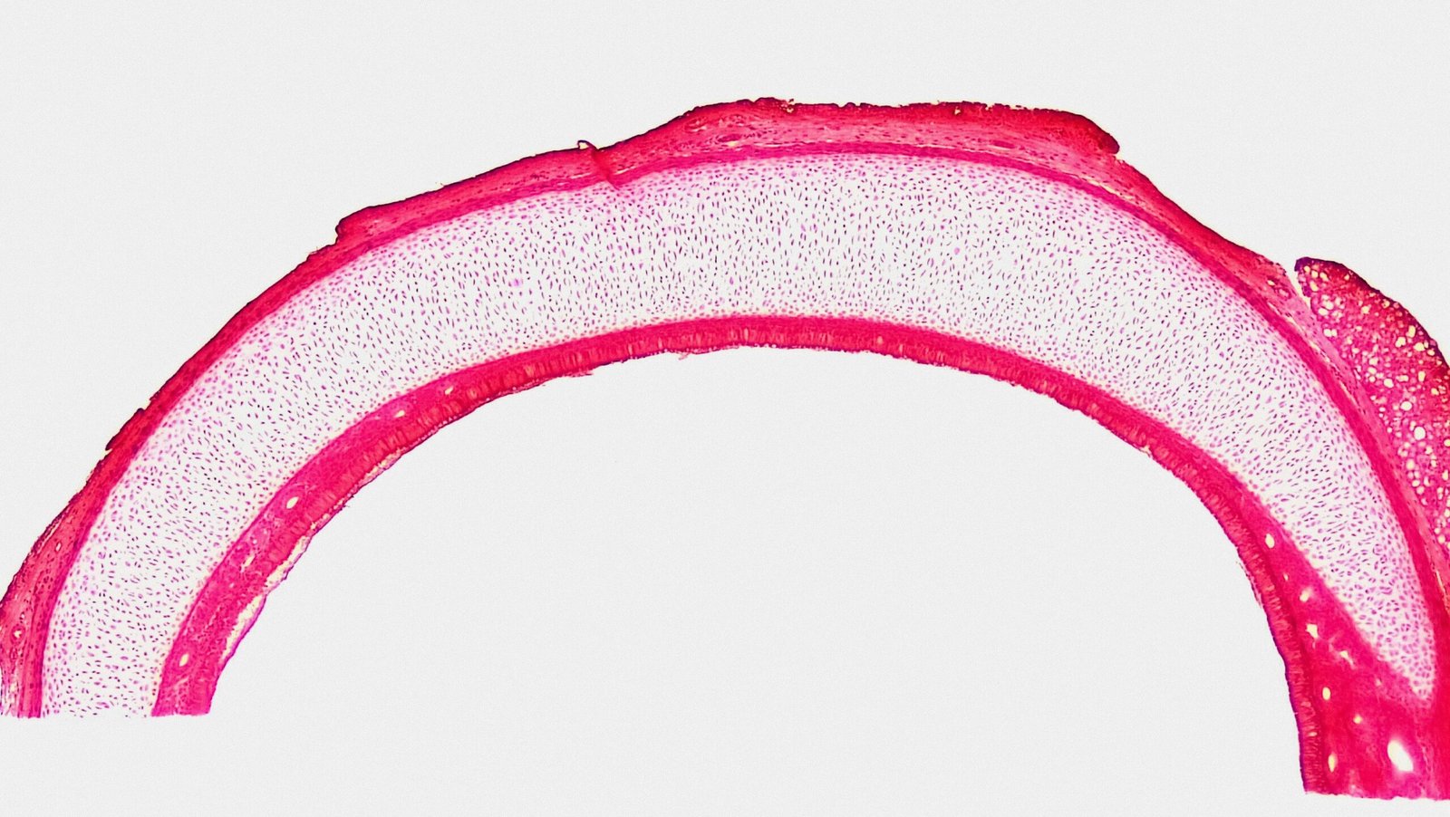 Connective Tissue: Hyaline Cartilage